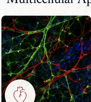 Cardiomyopathy research